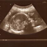 Quiz de l'embryon au foetus