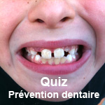 Quiz Prévention dentaire